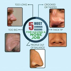 nose correction
